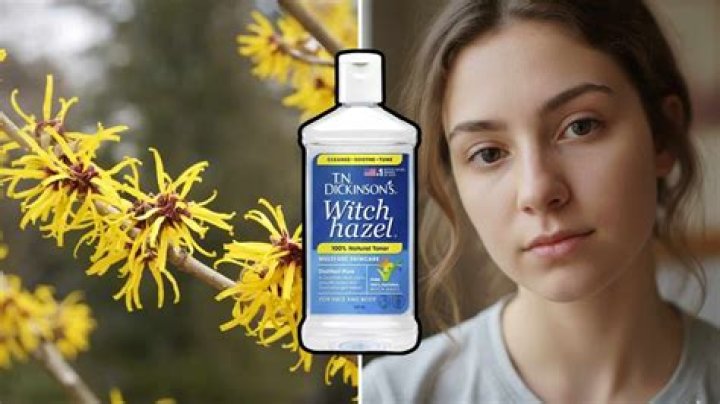 Do dermatologists recommend witch hazel?