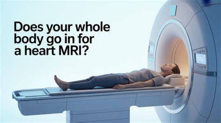 Does your whole body go in for a cardiac MRI?