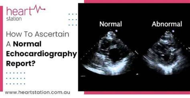 How do I know if my echocardiogram is normal?