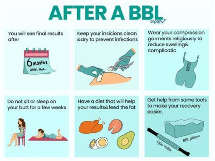 How do you pee after BBL?