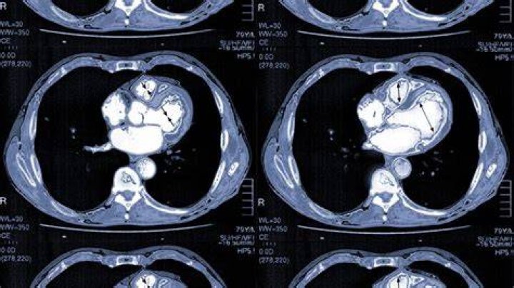 How much is a CT heart scan?