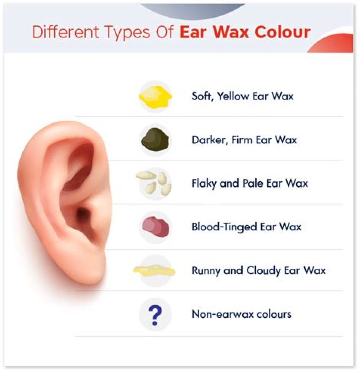 What Colour is baby ear wax?