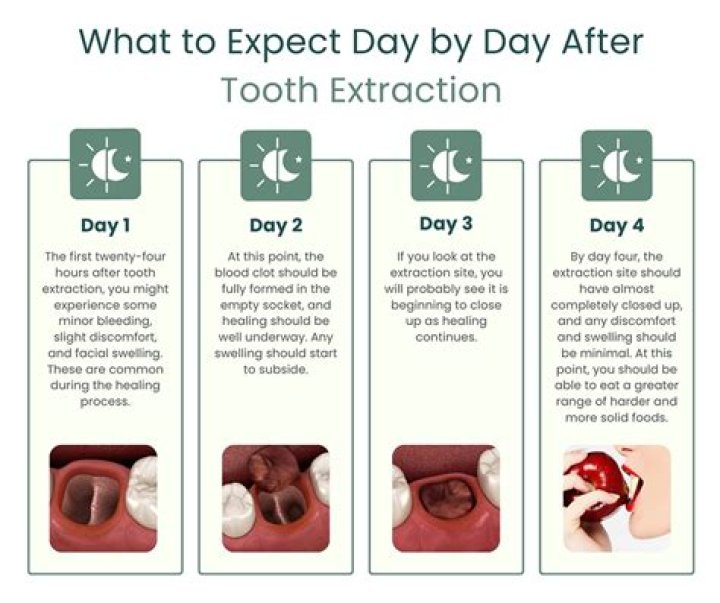 Which antibiotic is best after tooth extraction?